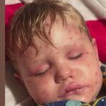 Georgia Toddler Stung 150+ Times by Yellowjackets: What to Know